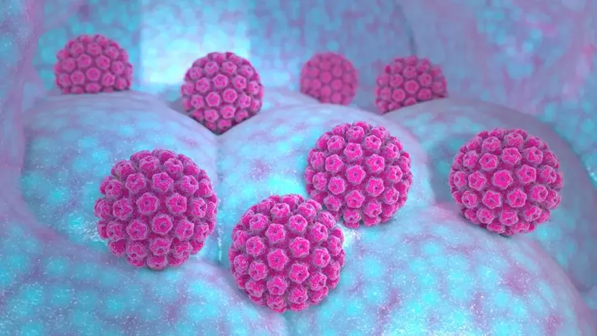 HPV